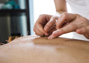 Photo of woman having acupuncture treatment. Alternative Medicine.