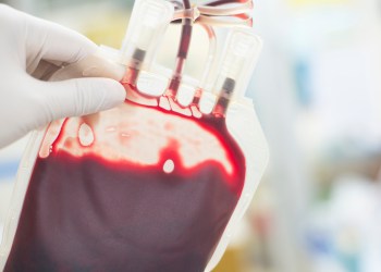 close up blood bag in laboratory medical concept.