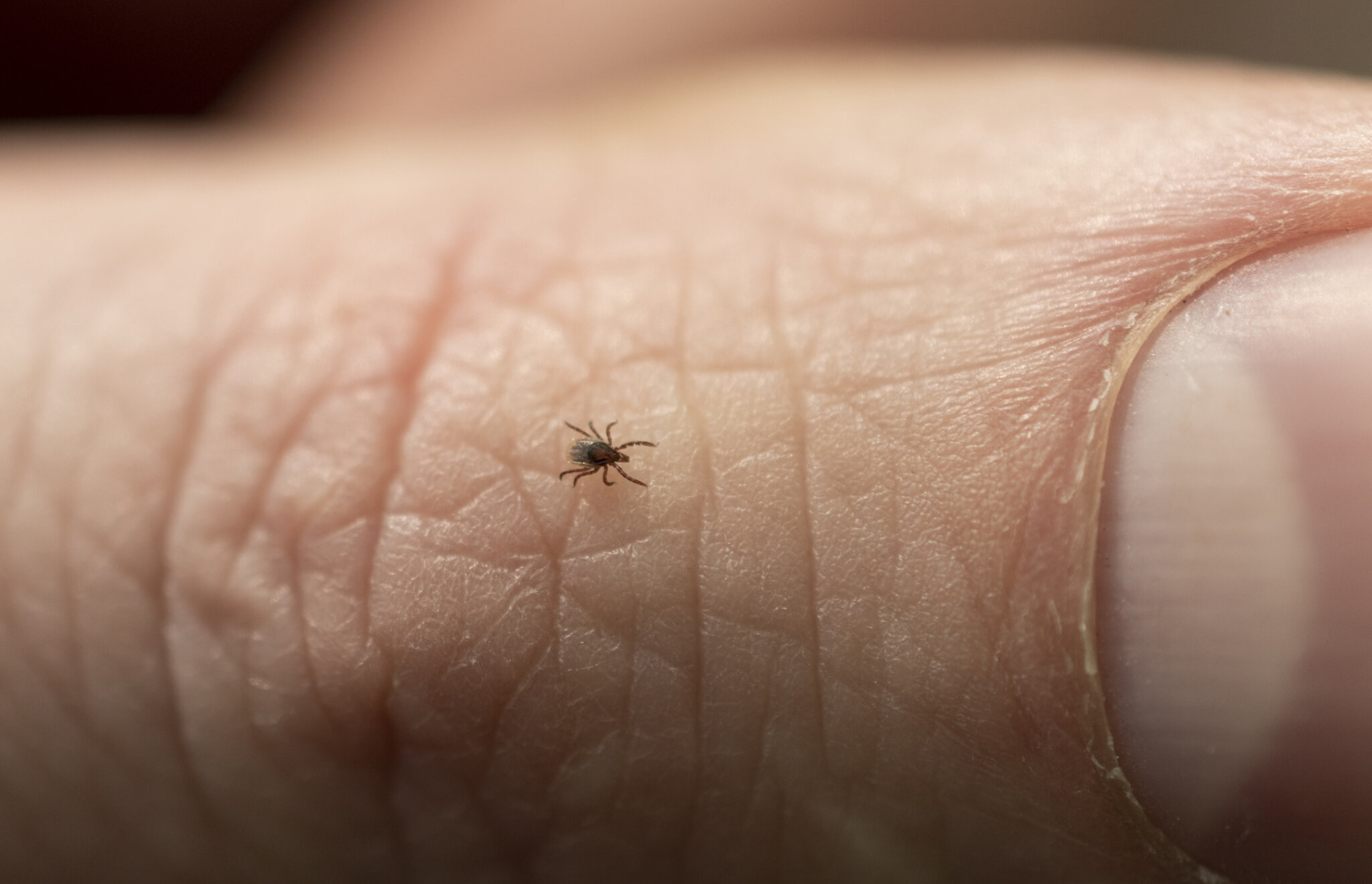 Tiny ticks carry Lyme disease