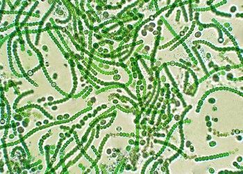 Nostoc is a genus of cyanobacteria found in various environments that forms colonies composed of filaments of moniliform cells in a gelatinous sheath.